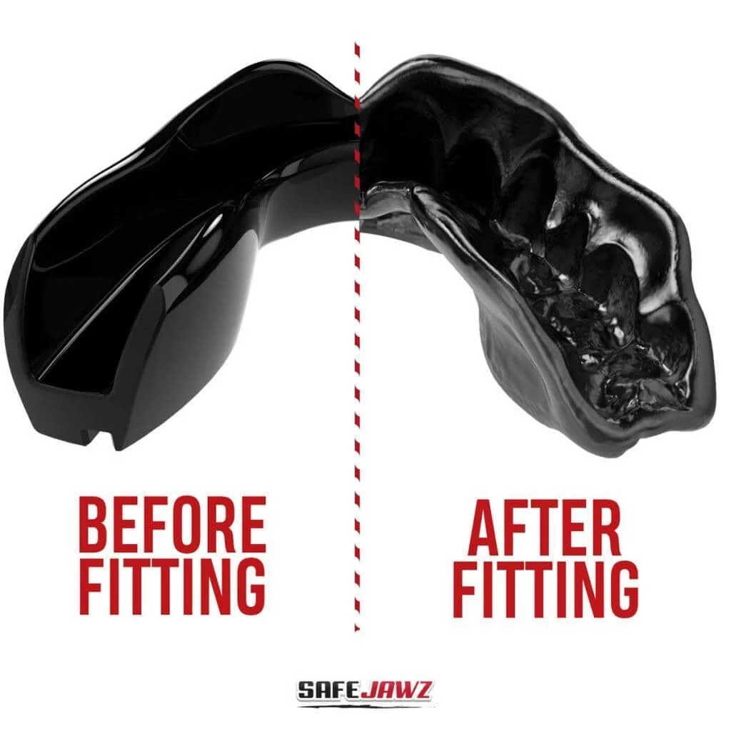 SafeJawz Intro Mouth Guard Black 5 SafeJawz Intro Mouth Guard Black - Image 3
