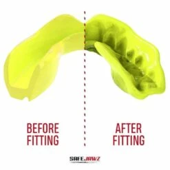 SafeJawz Intro Mouth Guard Fluro Yellow 8 SafeJawz Intro Mouth Guard Fluro Yellow -FightGearPro Sales Store safejawz intro mouth guard fluro yellow 3 8438 p